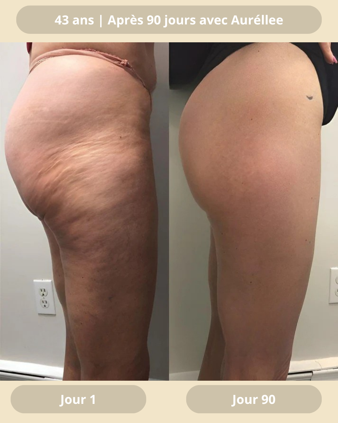 Huile naturelle anti-cellulite
