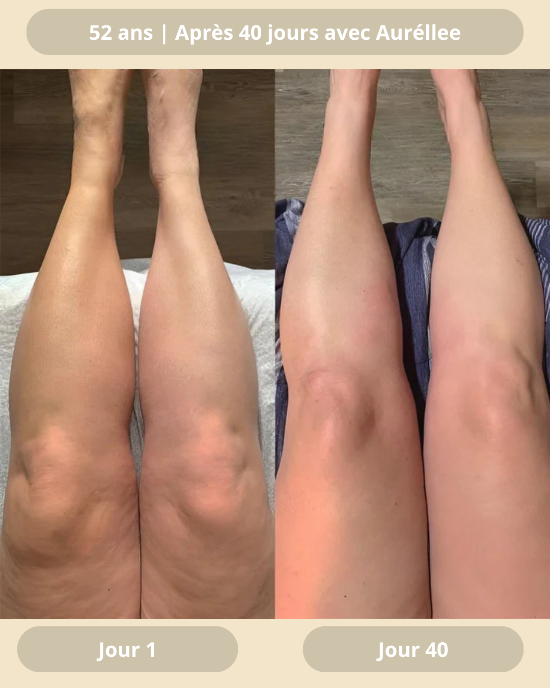 Huile naturelle anti-cellulite