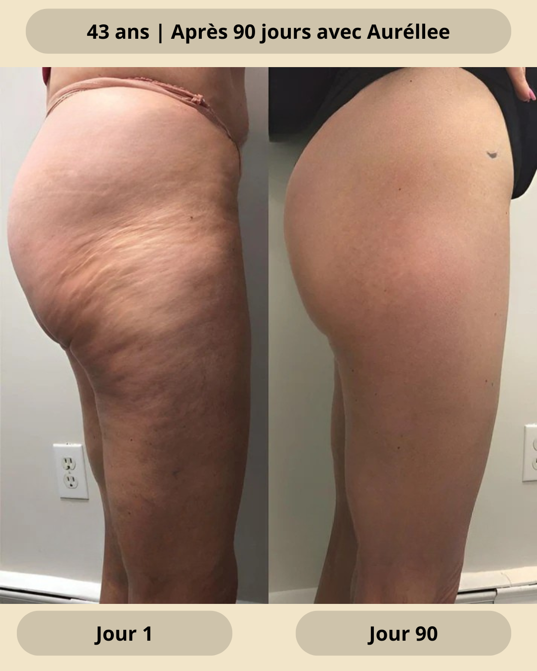 Huile naturelle anti-cellulite