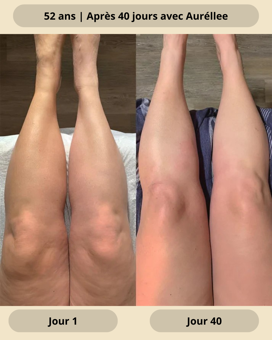 Huile naturelle anti-cellulite