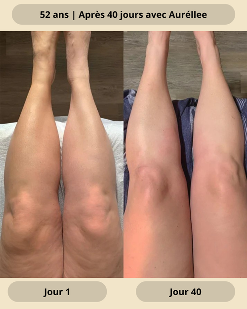 Huile naturelle anti-cellulite